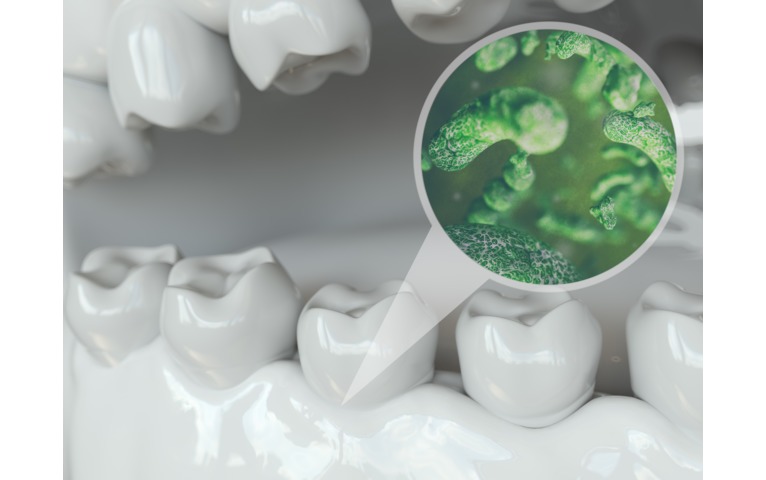 Baktérie sa usadia na zube hneď po hygiene